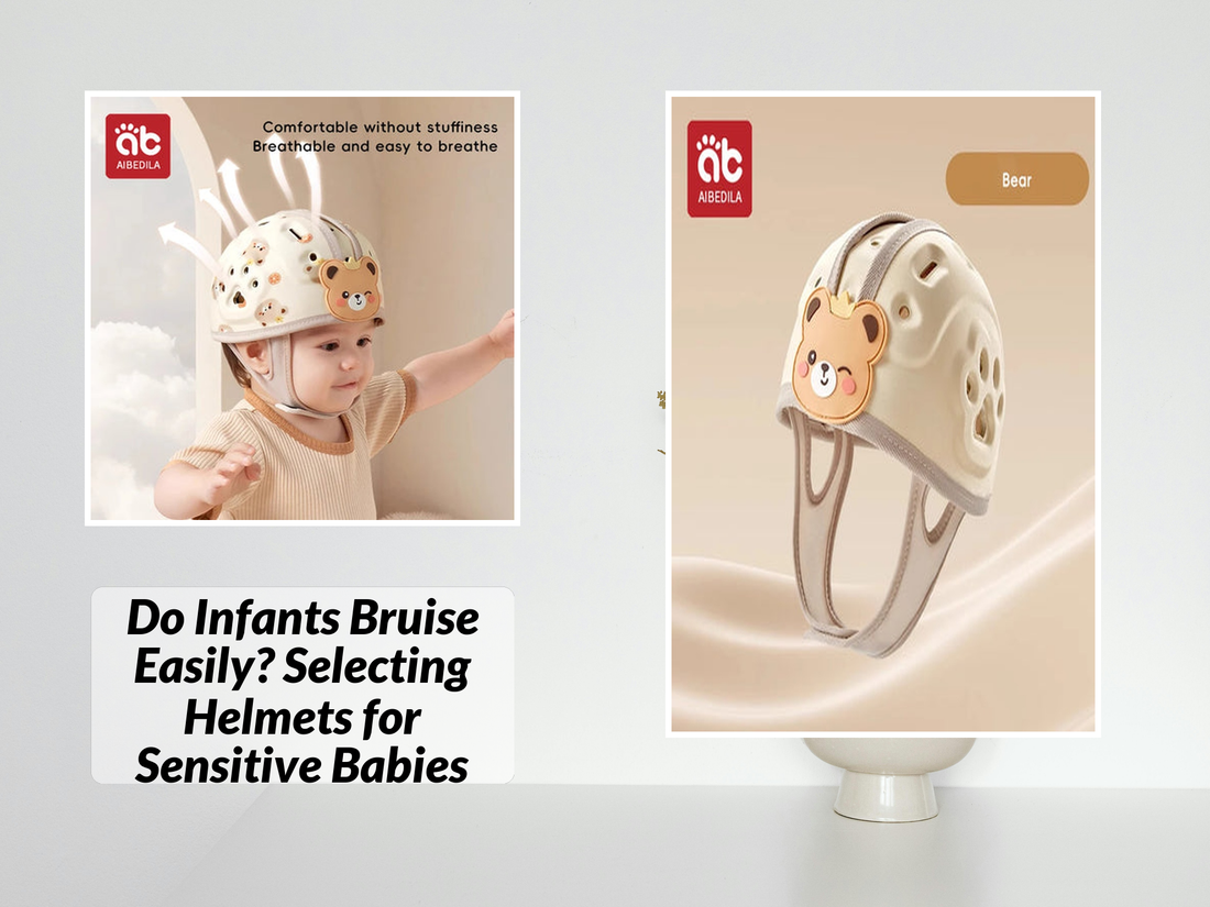 Do Infants Bruise Easily? Selecting Helmets for Sensitive Babies