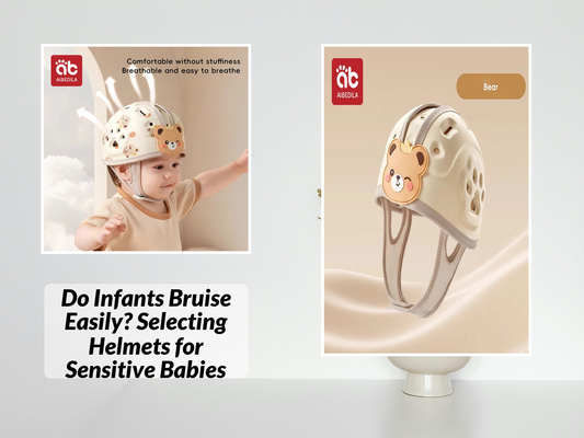 Do Infants Bruise Easily? Selecting Helmets for Sensitive Babies